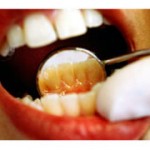 Как ухаживать за зубами